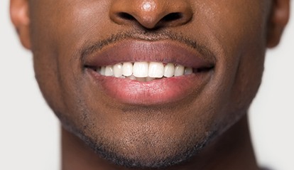 Closeup of smile improved with dental bonding in St. Albans